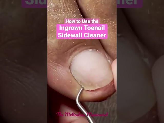 How to use the Ingrown Toenail Sidewall Cleaner #ingrowntoenail #pedicure #meticulousmanicurist