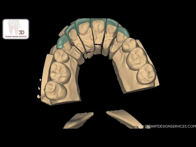 Perfect Design , Perfect Veneers – How We Do It at Digiart Design Services !