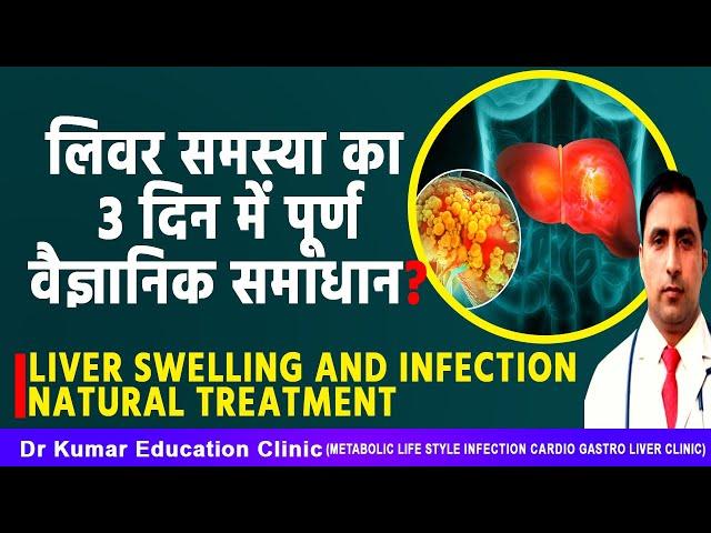 LIVER SWELLING AND INFECTION NATURAL TREATMENT// लिवर समस्या का 3 दिन में पूर्ण वैज्ञानिक समाधान?