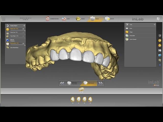 1 to 1 Copy Mode - inLab SW - Dentsply Sirona