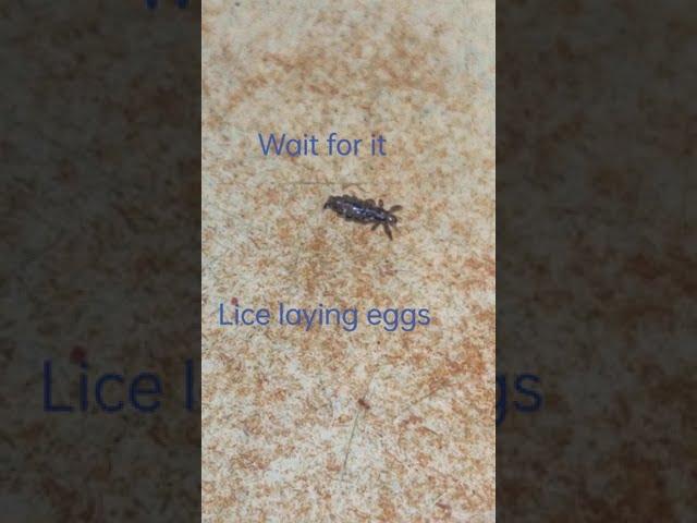 Lice removal | live lice egg laying | gross  | subscribe for more