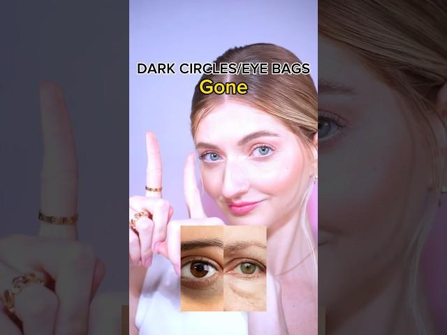 how to remove dark circles and eye bags? #darkcircles #eyebags #facemassage #faceyoga #faceexercise