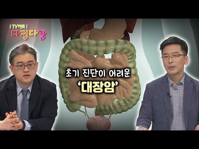 ‘의학 알지’ 대장암 X 대장암 발병 원인 / KBS대전 20210527 방송