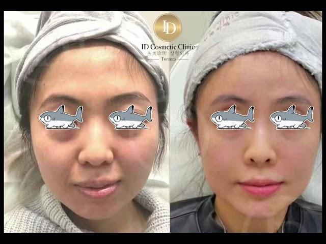 ID医美诊所｜ID Cosmetic Clinic 徐医生带你开启美丽旅程