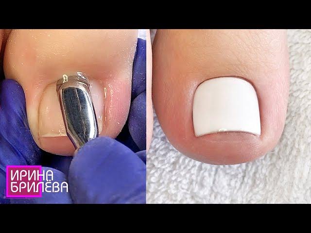 Monochromatic nail polish in pedicure  Treatment of toes  Irina Brilyova