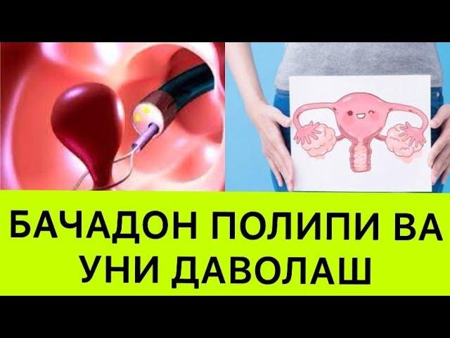 АЁЛЛАР БЕПУШТЛИГИ