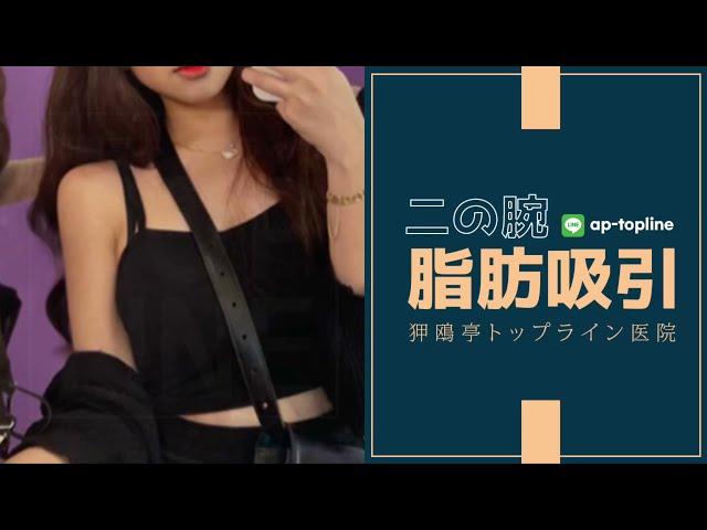 二の腕脂肪吸引ビフォーアフターレポ #二の腕ダイエット方法