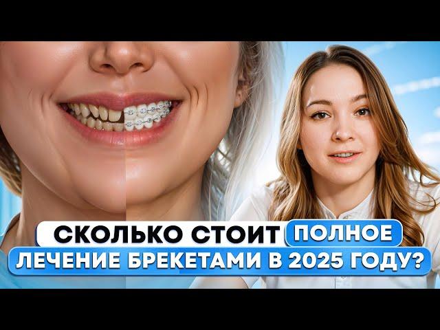 Что выбираете АЙФОН или БРЕКЕТЫ? – Сколько стоит ПОЛНОЕ ЛЕЧЕНИЕ БРЕКЕТАМИ? в 2025 году?