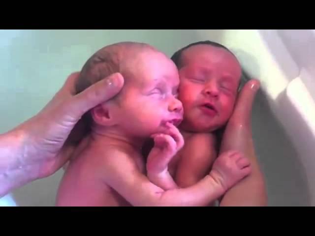 Эти близнецы родились, но пока еще не знают об этом. Трогательно!