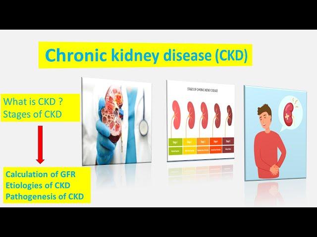 What is Chronic Kidney Disease (CKD) | Stages of Chronic Kidney Disease| GFR calculation
