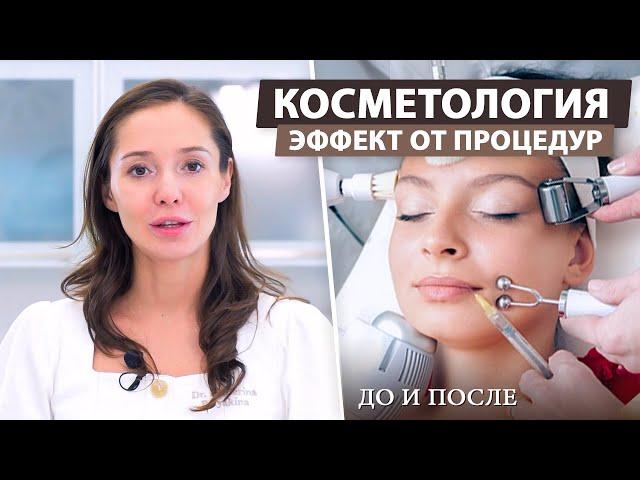 Почему эффект от косметологических процедур быстро проходит?