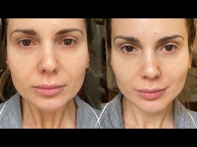 I've used NuFace for 30 days and this is my review | ALI ANDREEA