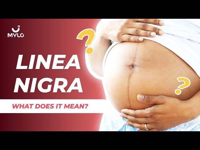 Linea Nigra | When Does Linea Nigra Appear? | What Does Linea Nigra In Pregnancy Mean? | Mylo Family