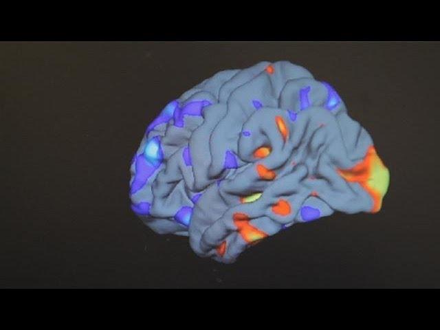 Аутизм. В ожидании прорыва - science