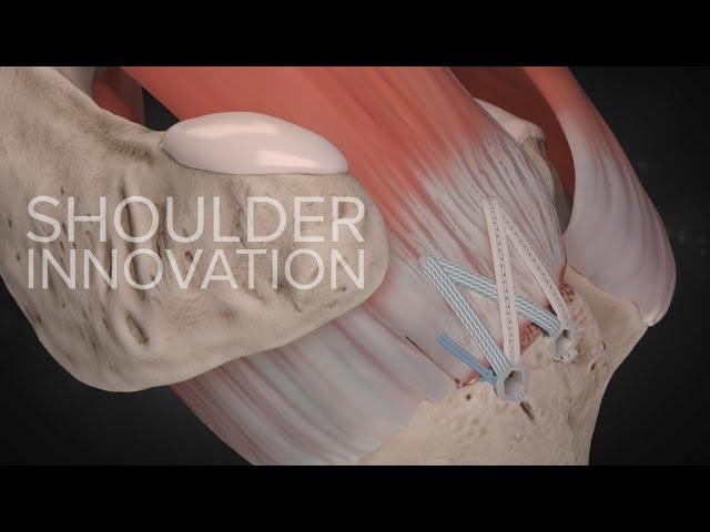What's New in Orthopaedic Innovations