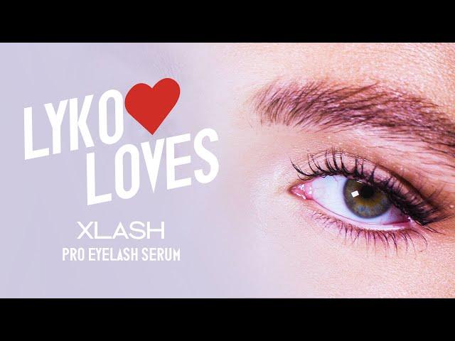 Lyko Loves - Xlash