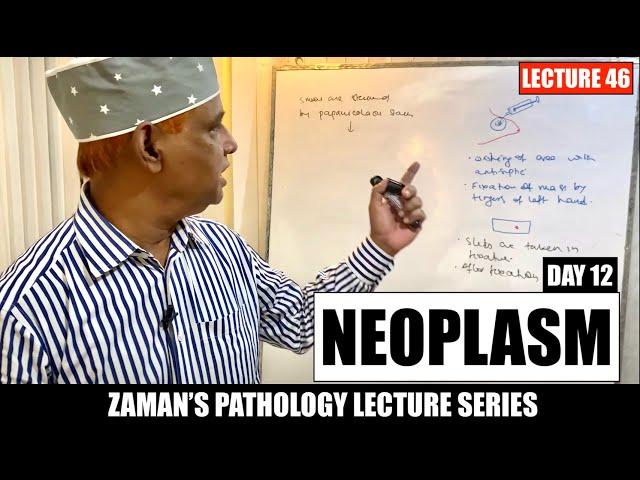 General Pathology: Lecture 46 | Neoplasm - Day 12