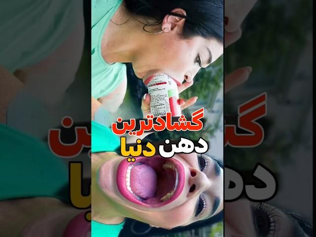 دهن این آدم رو دیدین؟#shortvideo#shorts