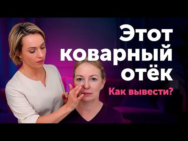 Почему ЭТОТ ОТЁК НЕ УХОДИТ? Разбор реального случая