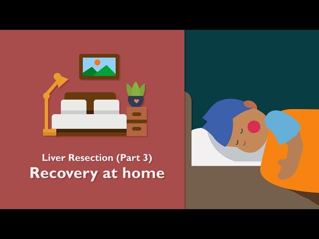 Recovery at Home after Liver Resection Surgery | TVASurg Patient Learning