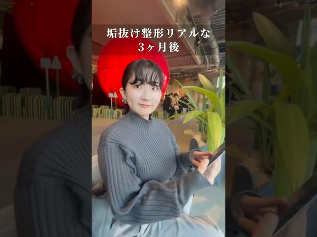 【必見】脂肪吸引すると3ヶ月でどれだけ変わるのか！？