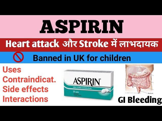 ASPIRIN USES, DOSAGE, MODE OF ACTION, CONTRAINDICATIONS, SIDE EFFECTS AND DRUG INTERACTIONS