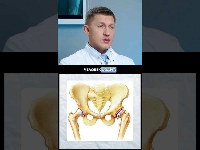 Это приведет вас к операции по замене тазобедренного сустава.