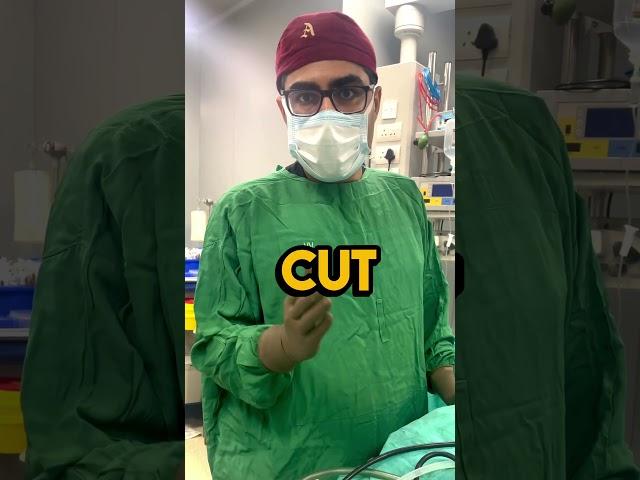 Scarless Gynecomastia Surgery Techniques | Male Breast Surgery in India | Plastic surgeon in India