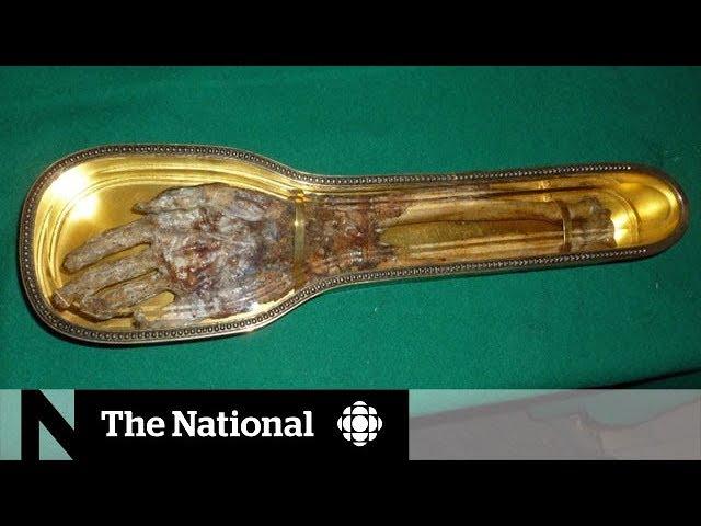 St. Francis Xavier's severed forearm to tour Canada