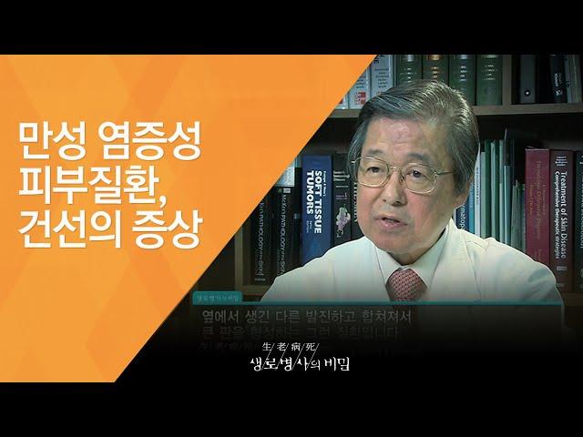 만성 염증성 피부질환, 건선의 증상 - (20121110_435회 방송)_평생의 고통, 건선