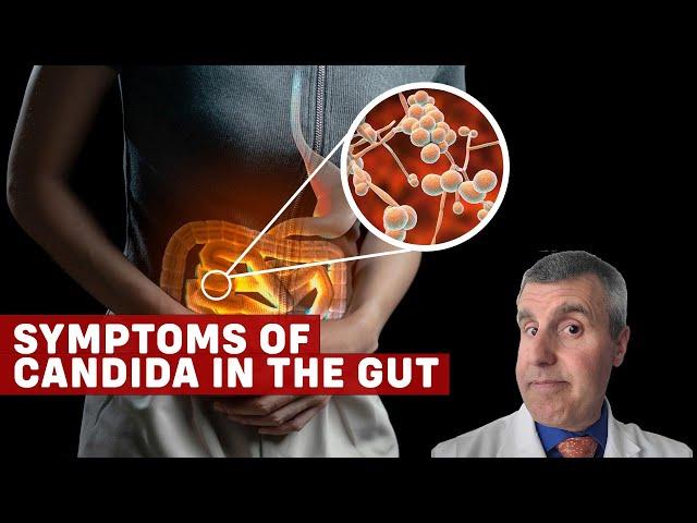 Candida Overgrowth Symptoms