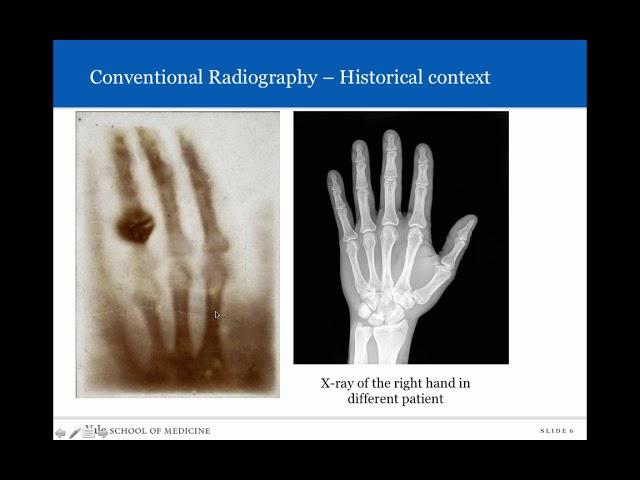 Introduction to Radiology: Conventional Radiography