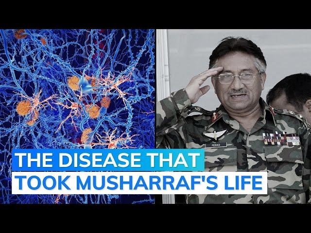 Pervez Musharraf: What’s Amyloidosis, The Disease Pakistan’s Former President Was Suffering From?