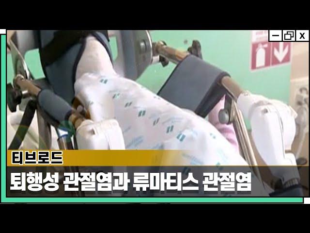 같은 듯 다른 퇴행성 관절염과 류마티스 관절염 [티브로드 방송 - 웰튼병원 송상호 병원장]