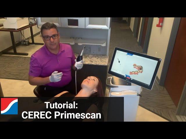 How To Use CEREC Primescan Intraoral Scanner