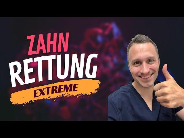 Zahnerhaltung im Grenzbereich  | Zahnarzt Dr. Maximilian Fuhrmann