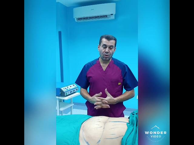 شد البطن - شد ترهلات البطن - د. صابر عبد المقصود استاذ جراحة التجميل و نحت القوام