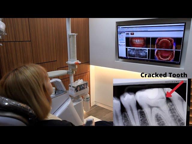 Crown Fitting at Luxury Korean Dental Clinic