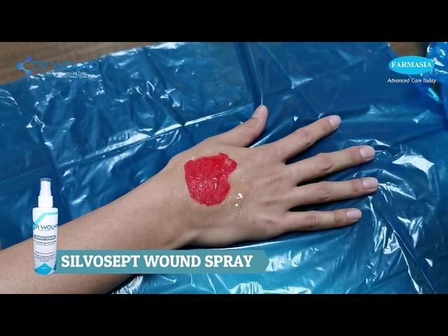 Burns & cuts? Tips to clean your wound FAST!!!