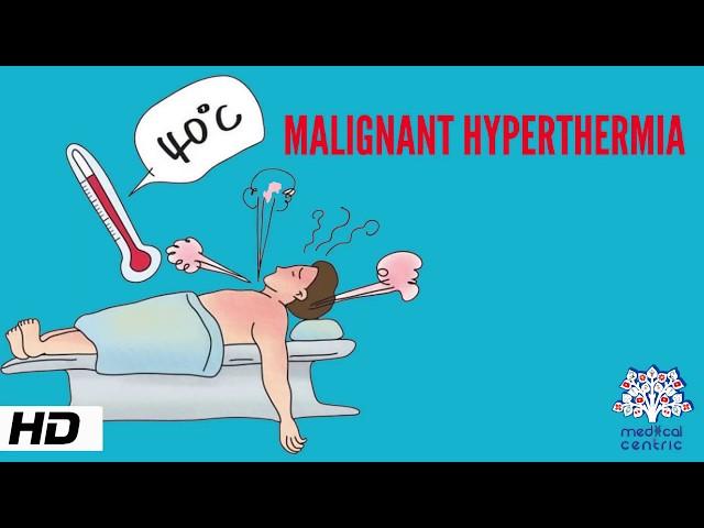 MALIGNANT HYPERTHERMIA, Causes, Signs and Symptoms, Diagnosis and Treatment.
