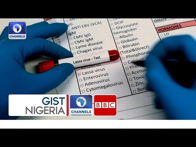 Lassa Fever In Nigeria Preventing The Spread