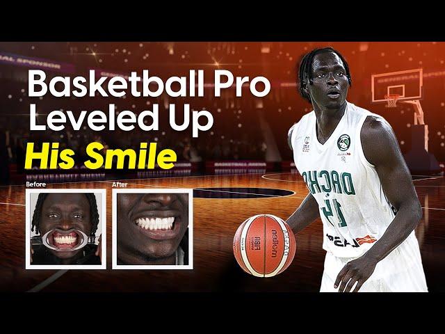 Both Tut’s Smile Makeover in Istanbul 