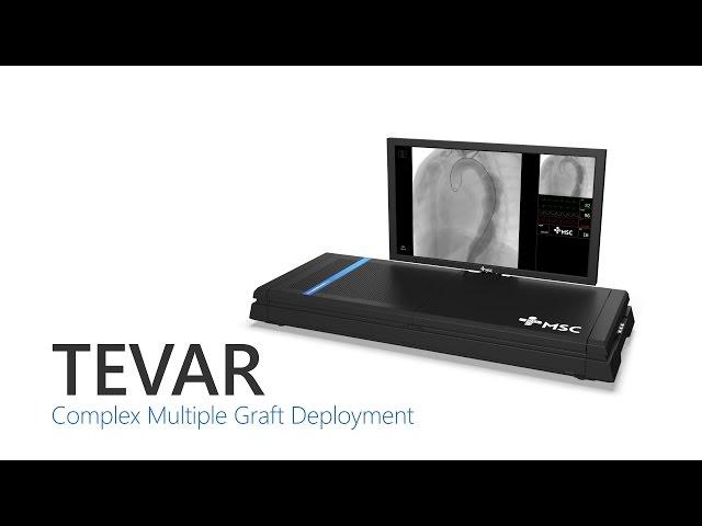 Thoracic Endovascular Aortic Repair (TEVAR)