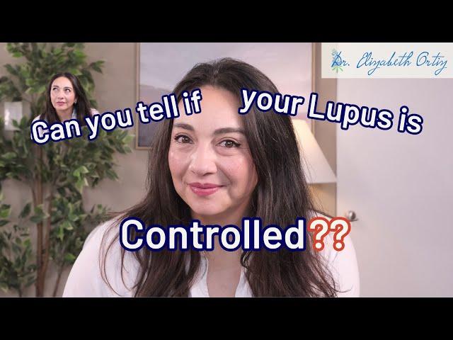 How do you know if your lupus is controlled? 5 signs it's not as controlled as you think