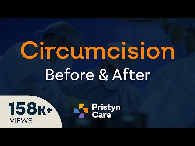 Before v/s After Laser Circumcision Surgery