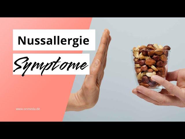 Nussallergie: Diese Symptome sind möglich