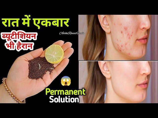 कितनी भी पुरानी झाइयां, Pigmentation जड़ से खत्म करें 100% रिजल्ट || How To Remove Pigmentation