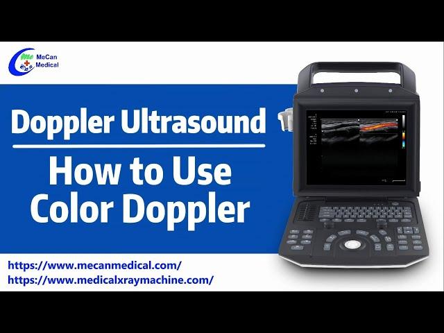 Doppler Ultrasound | Live Demonstrate How to Use Color Doppler | MeCan Medical