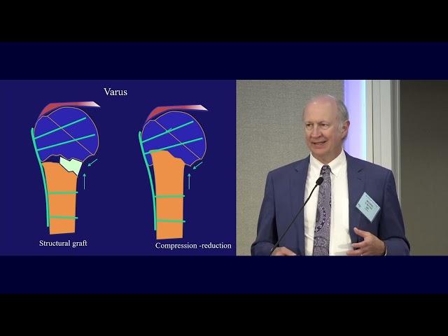 06  Proximal Humerus Fractures   Michael Mckee, MD