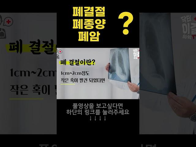 폐결절 폐종양 폐암 구분법